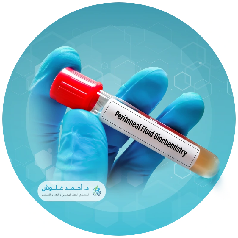 بزل السائل البريتونى